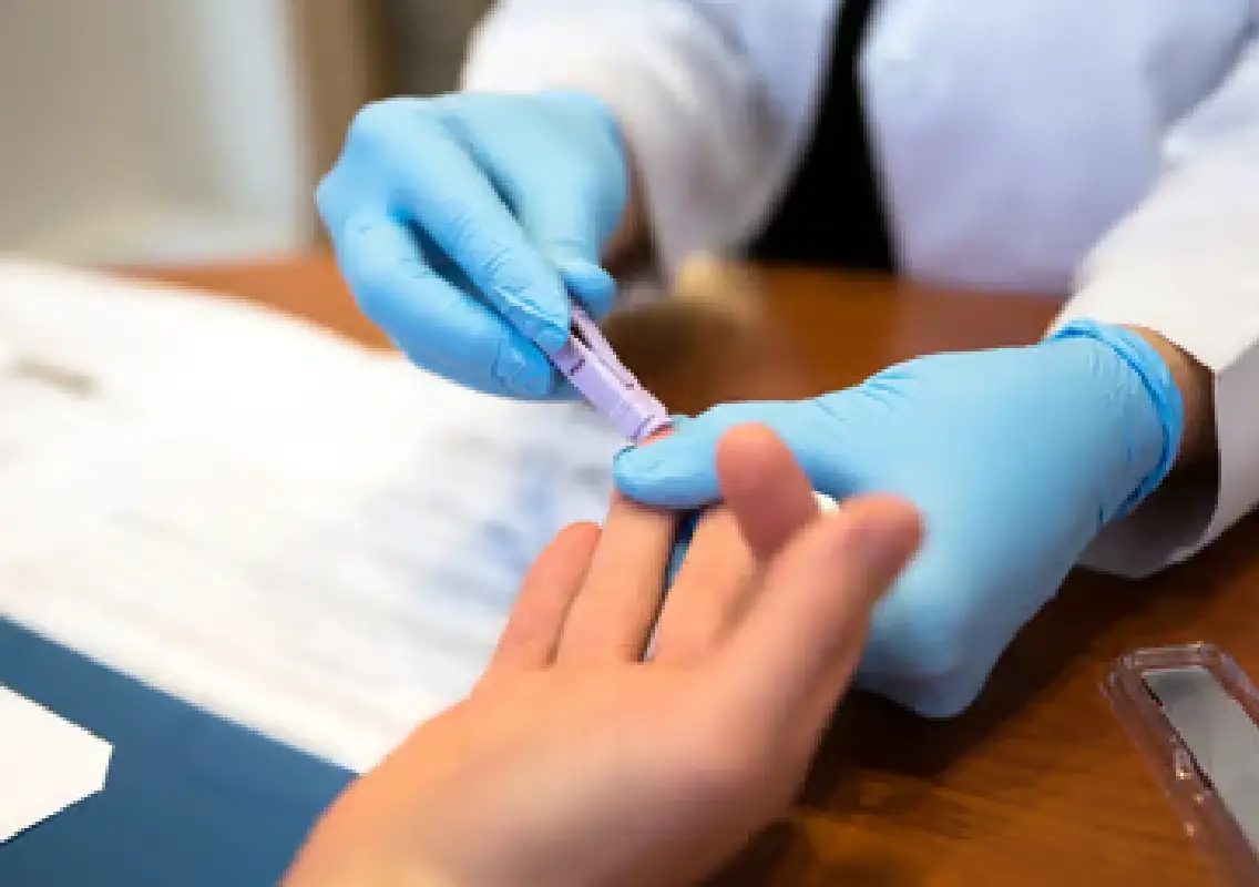 Viral reel linking dandruff to HIV draws expert clarification - News Karnataka