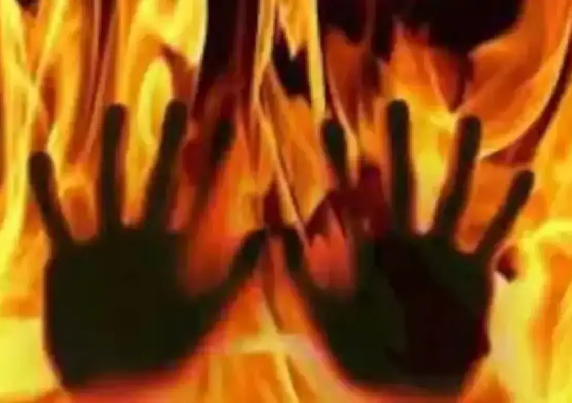 Young man dies after being set on fire, family alleges murder - News Karnataka