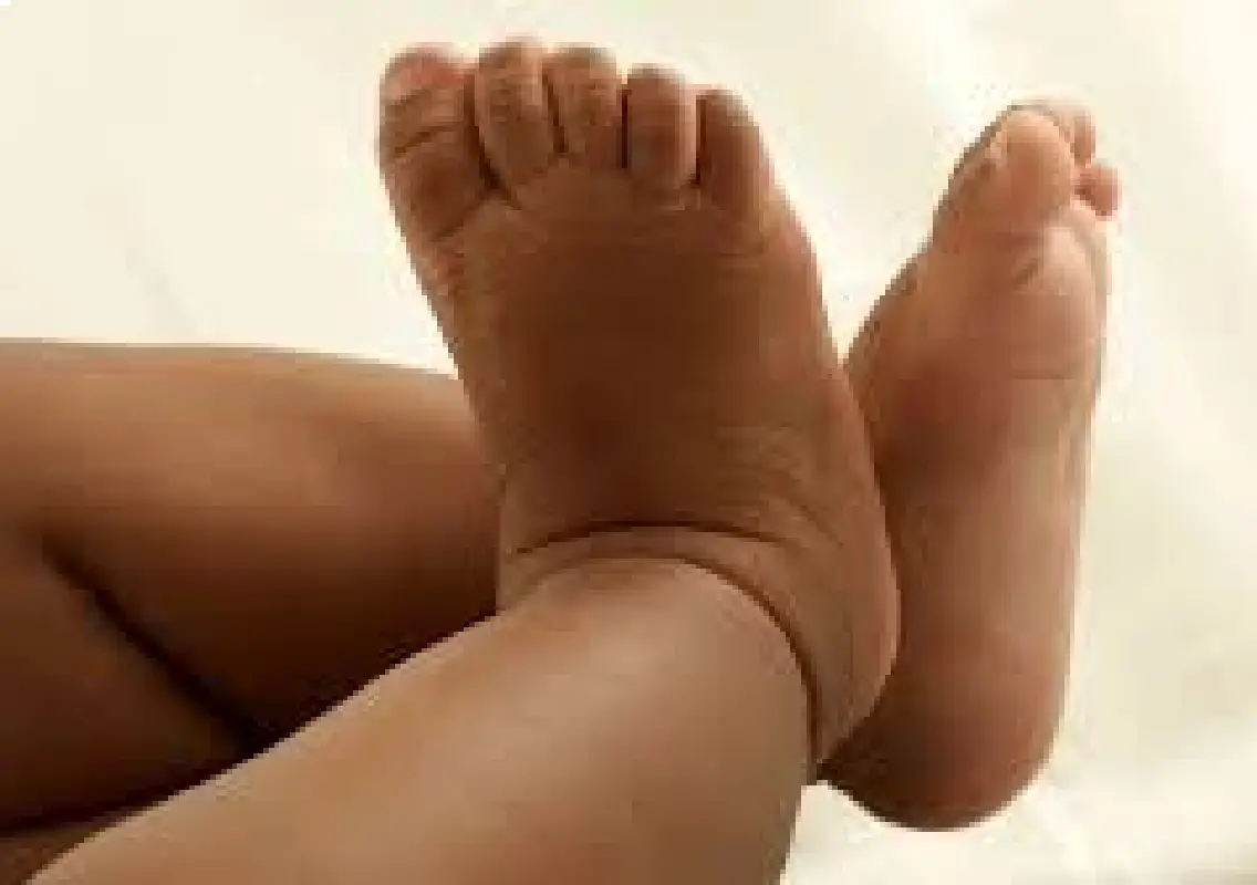 Abandoned newborn found in cement bag now out of danger - News Karnataka