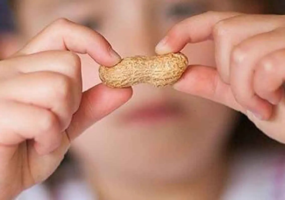 Early peanut intake may reduce allergy risk in younger siblings - News Karnataka