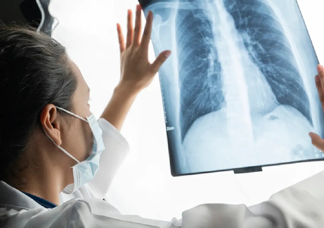 Hidden habits raising lung cancer risk you must not ignore - News Karnataka