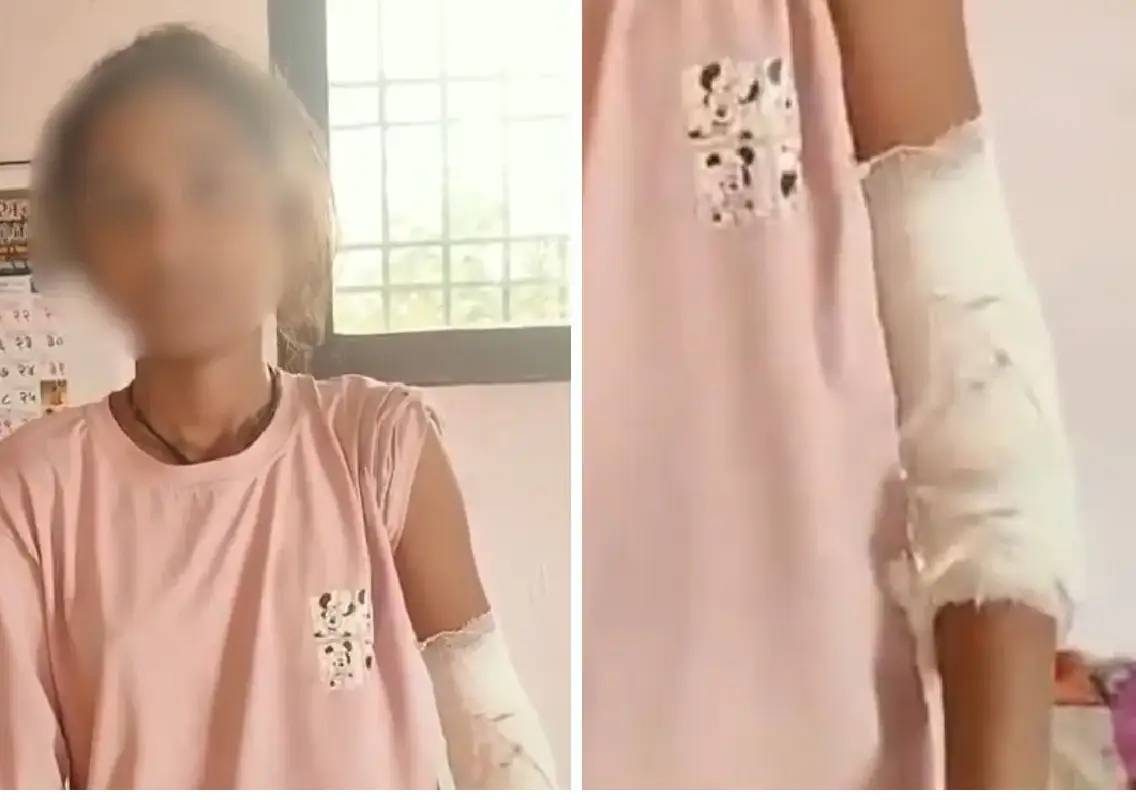 Teacher booked after Nagpur student injured over math mistake - News Karnataka