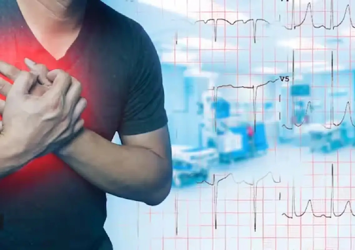 360 daily sudden deaths in India: CPR awareness urged - News Karnataka