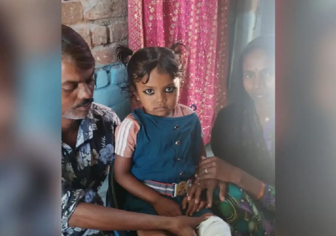 5-year-old’s leg amputated after treatment, doctor booked - News Karnataka