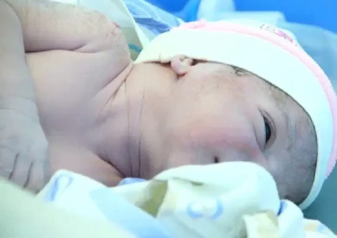 6-year-old ‘blue baby’ gets new life after heart surgery - News Karnataka