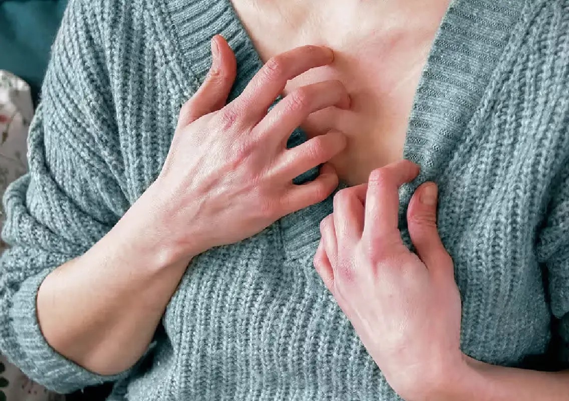 Cold, flu or allergies? Doctors say timing and itching can help you tell - News Karnataka