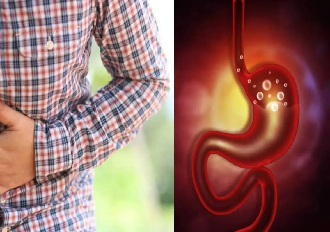 7 signs gas may be a gut motility disorder - News Karnataka