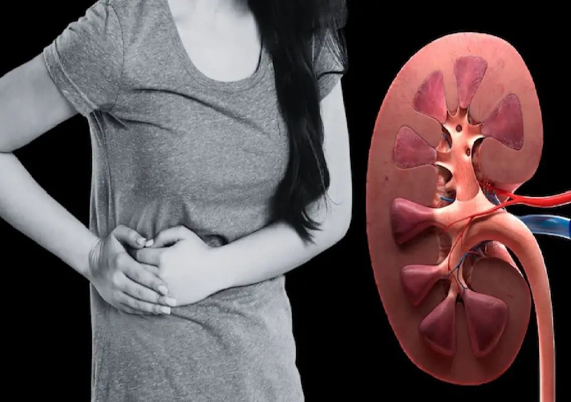 Summer heat triggers rise in kidney stone cases: Doctors warn - News Karnataka