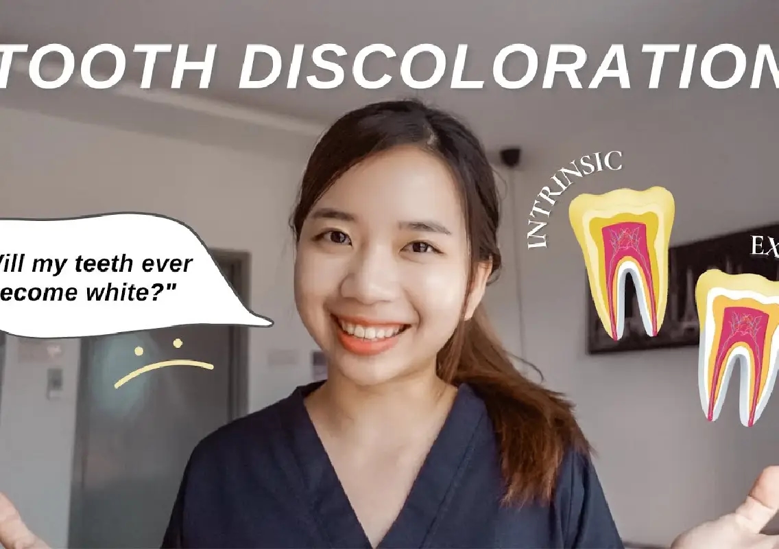 Why teeth turn yellow even if you brush daily, says dentist - News Karnataka