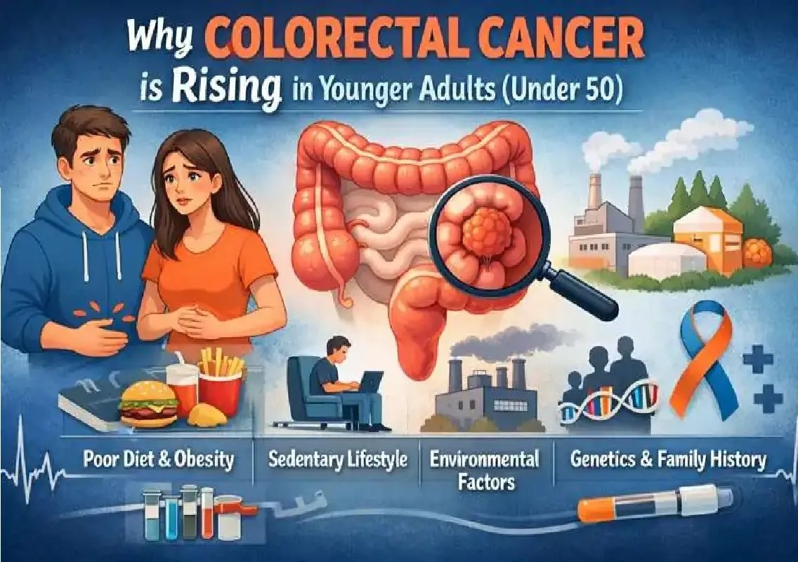 Asia faces rising bowel cancer burden amid limited screening - News Karnataka