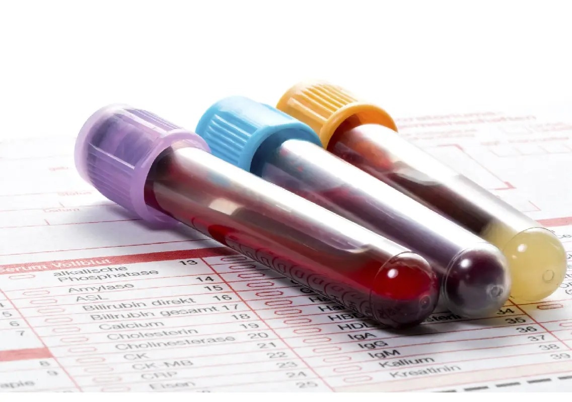 Same blood test, different results? Why experts are concerned - News Karnataka