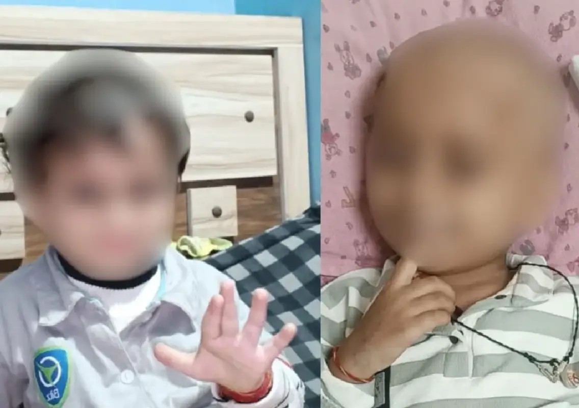 3-year-old cancer patient dies after alleged chemical injection - News Karnataka