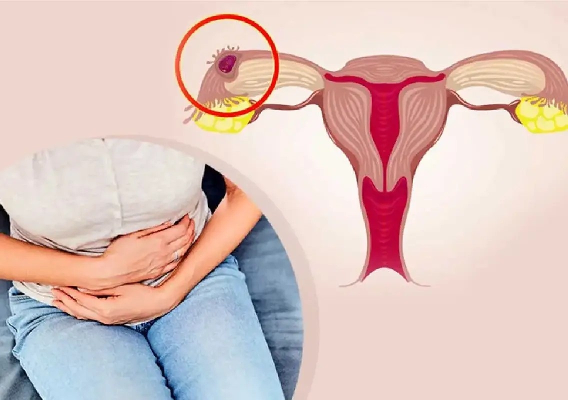 Bengaluru cracks down on fake gynaecologists treating pregnant women - News Karnataka