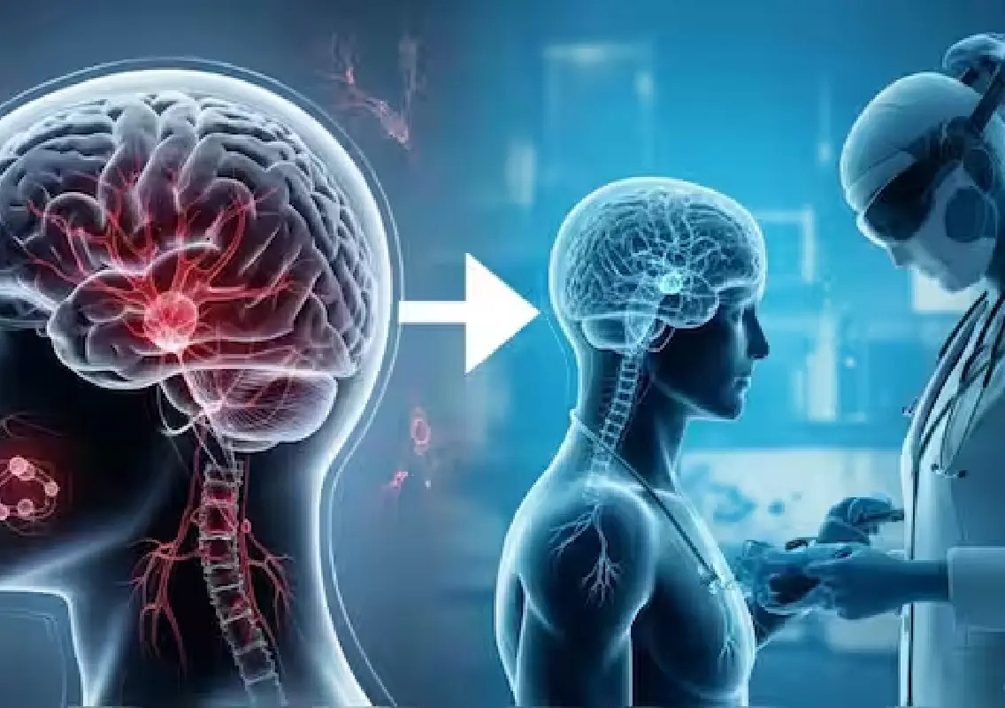 Brain tumour symptoms often mistaken for stress, doctors warn - News Karnataka
