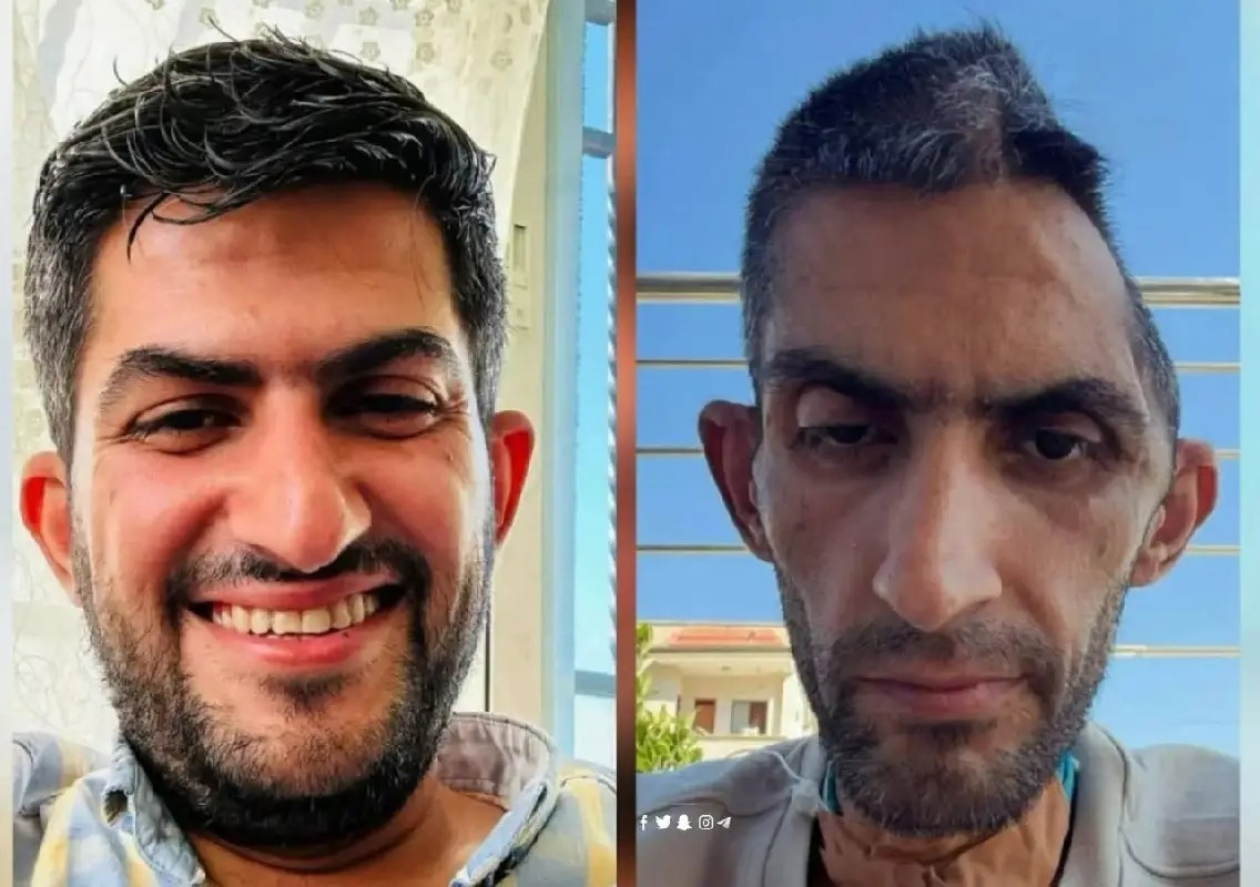 Palestinian journalist undergoes surgery after release from detention - News Karnataka