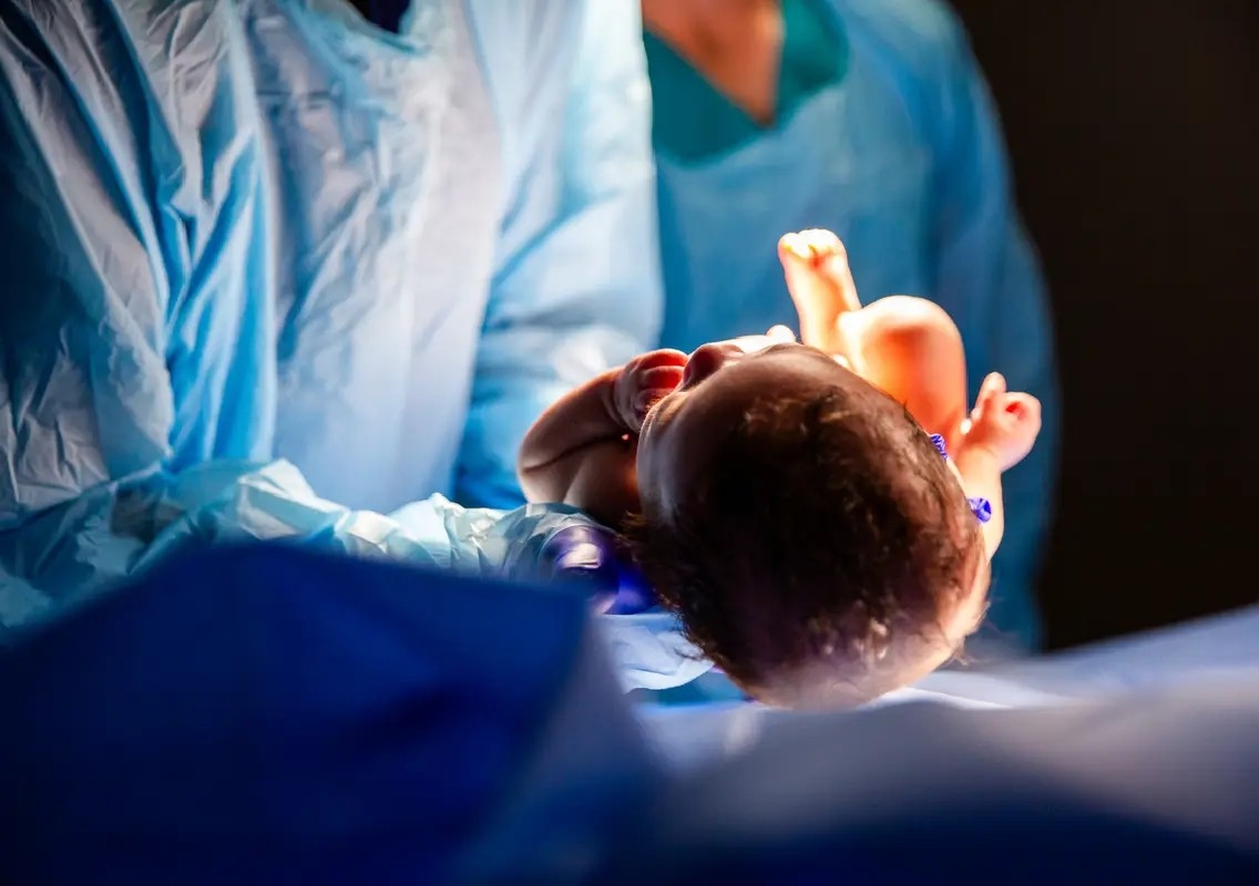 Bengaluru hospital reports 70% natural births amid C-section debate - News Karnataka