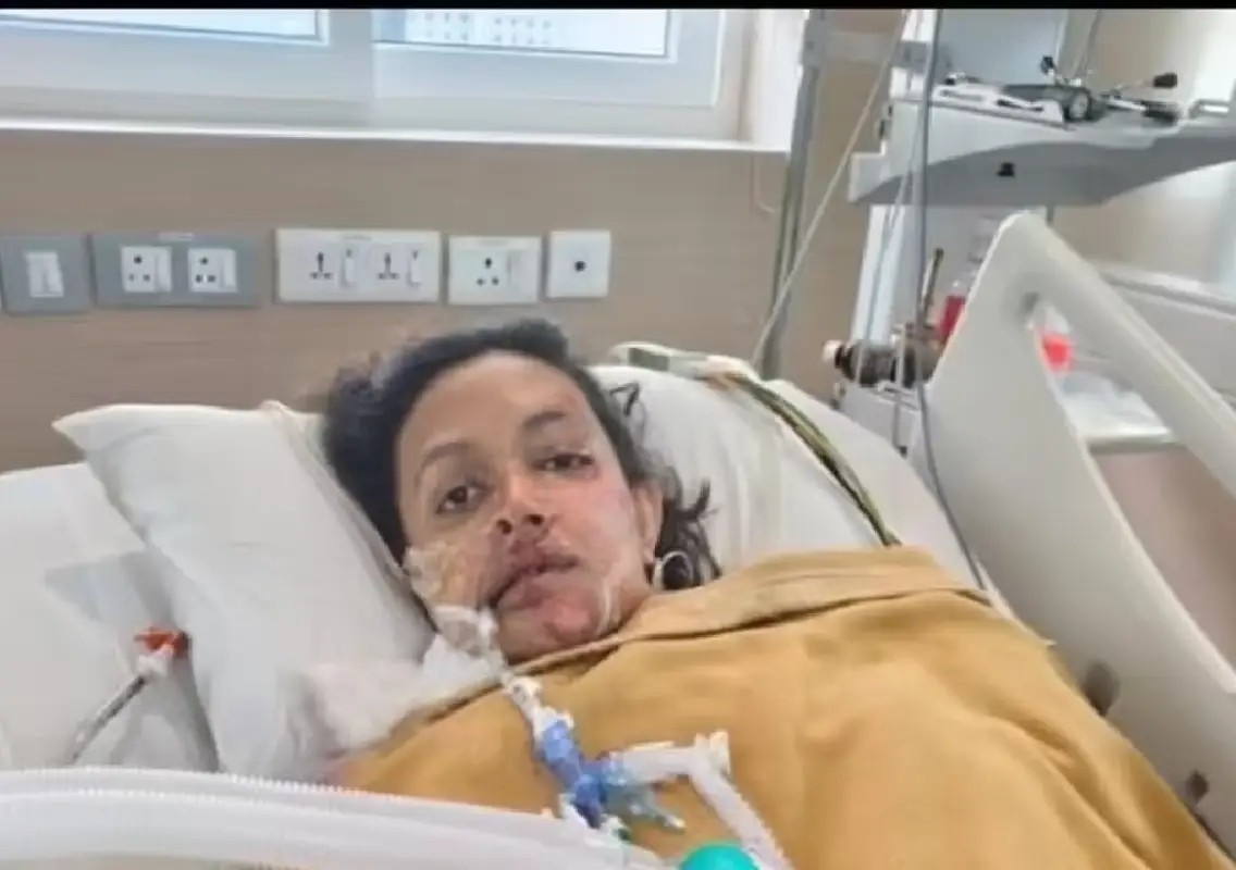 Bengaluru woman's bike taxi accident sparks safety concerns - News Karnataka