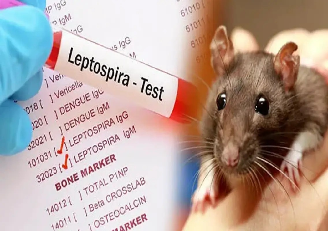 Rat fever cases rise in Dakshina Kannada during monsoon - News Karnataka