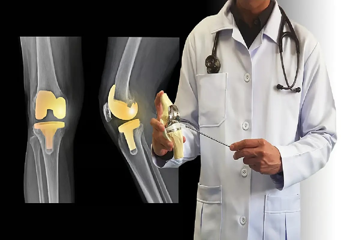 Chennai surgeon to showcase knee replacement innovation in Canada - News Karnataka
