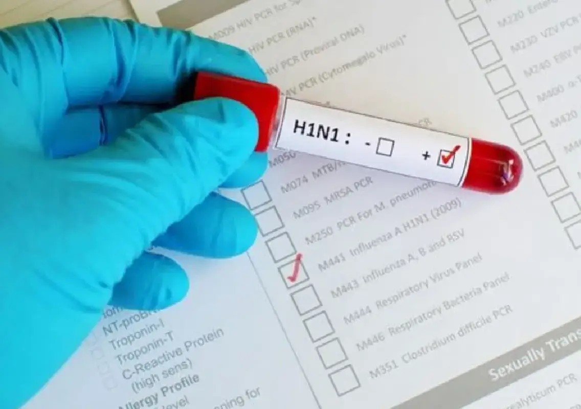 Delhi records sharp rise in H1N1 cases as monsoon continues - News Karnataka