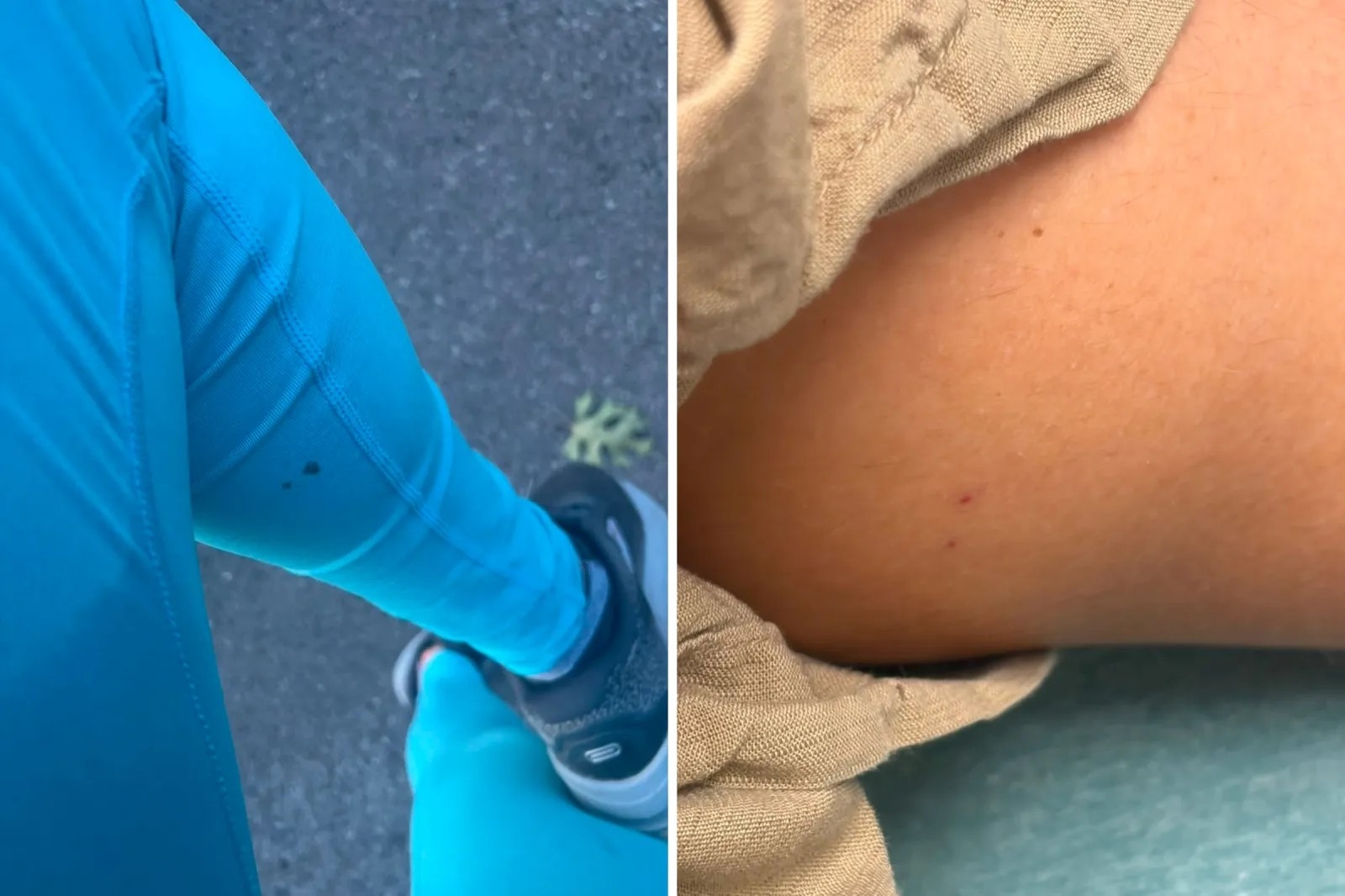 Evening jog turns frightening as woman is bitten by a bat - News Karnataka