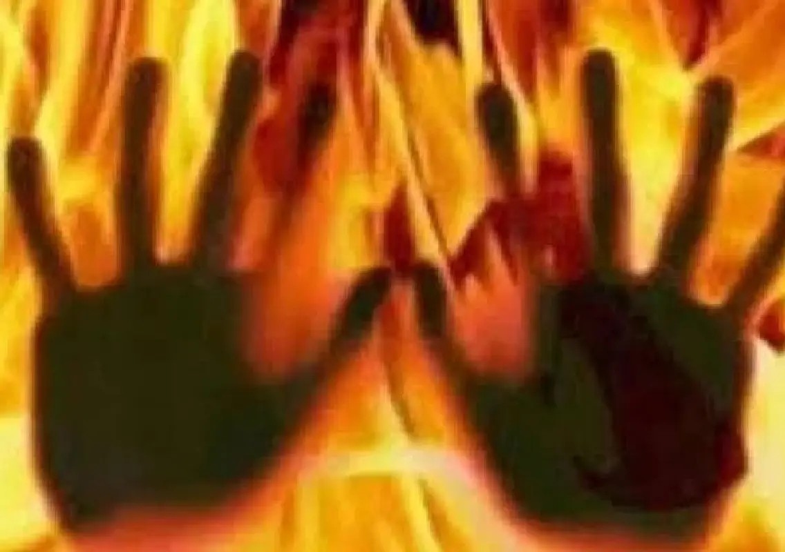 Nepalese woman battles for life after husband allegedly sets her on fire - News Karnataka