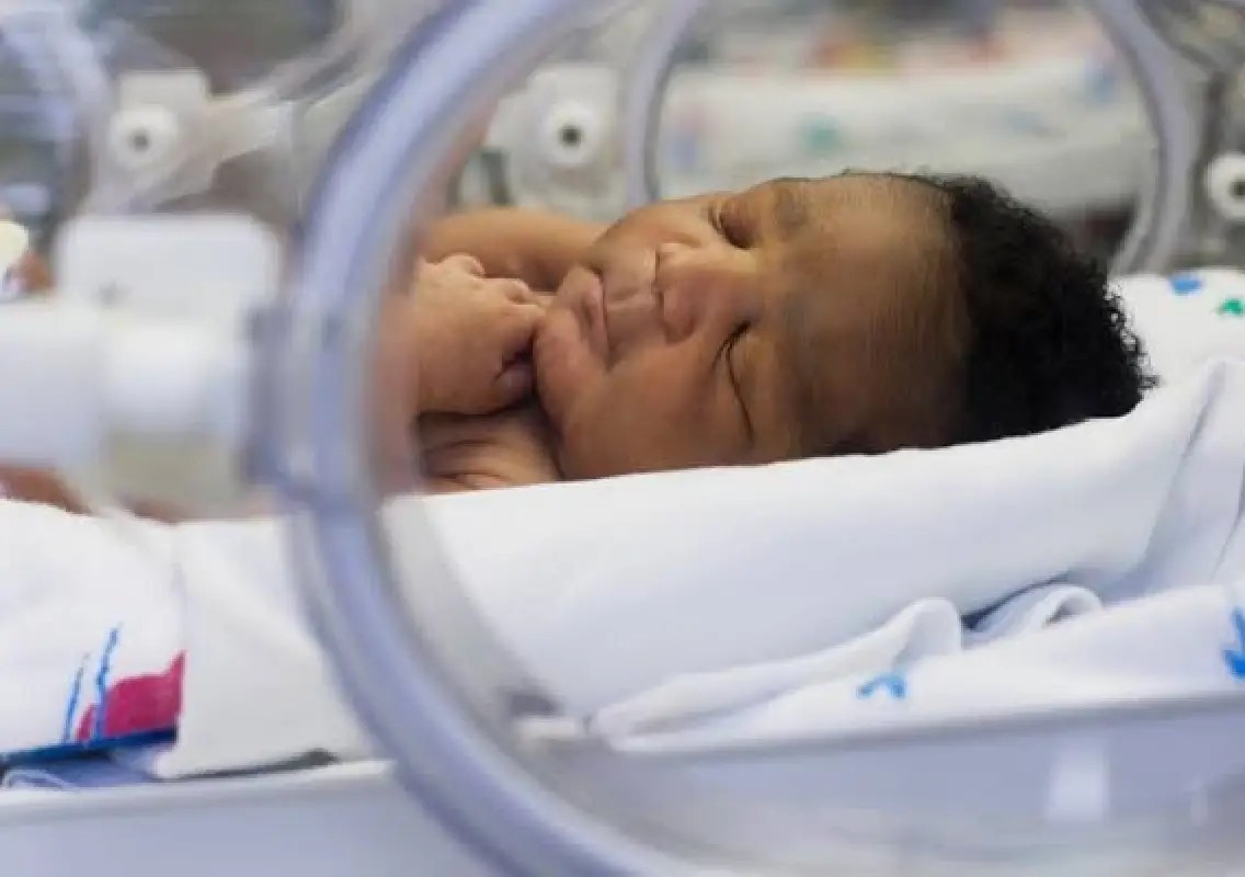 New light-based scan may spot deadly bowel disease in premature babies - News Karnataka