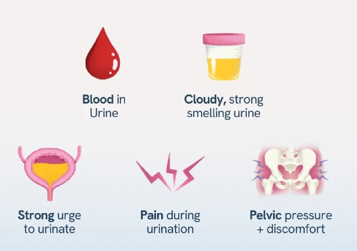 Simple estrogen application may help prevent repeat UTIs - News Karnataka