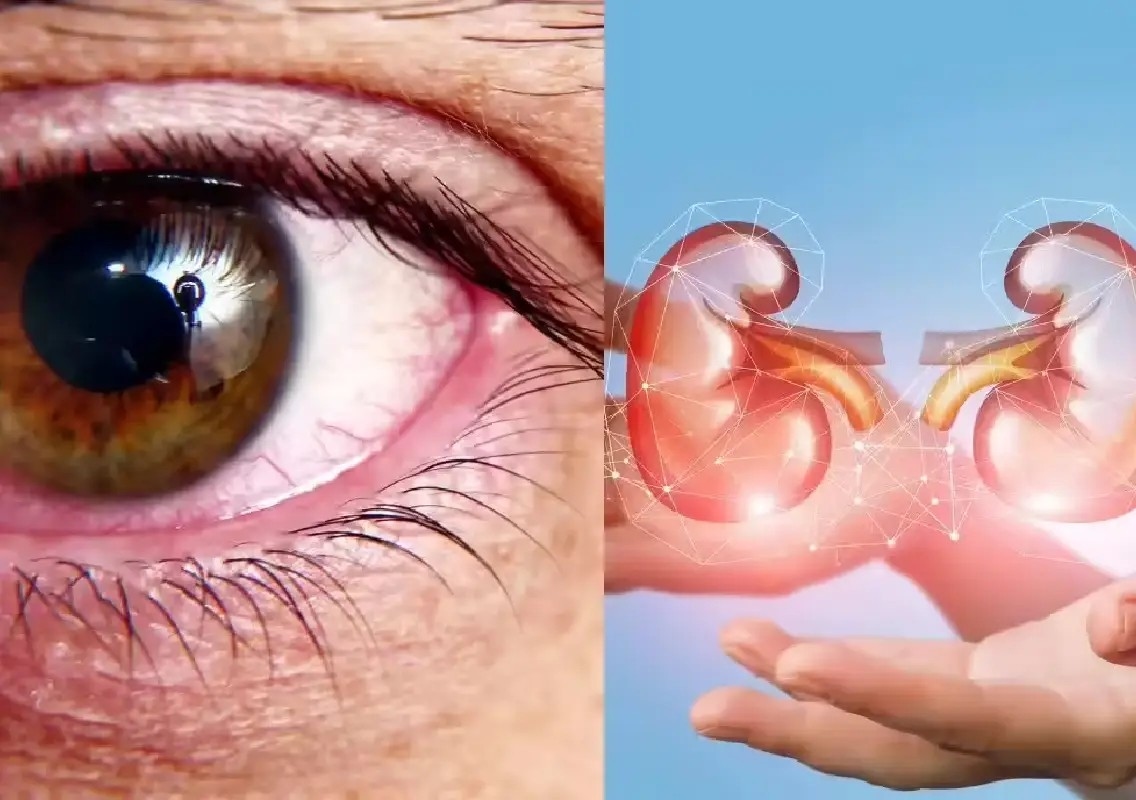 These unusual signs could point to hidden kidney problems - News Karnataka