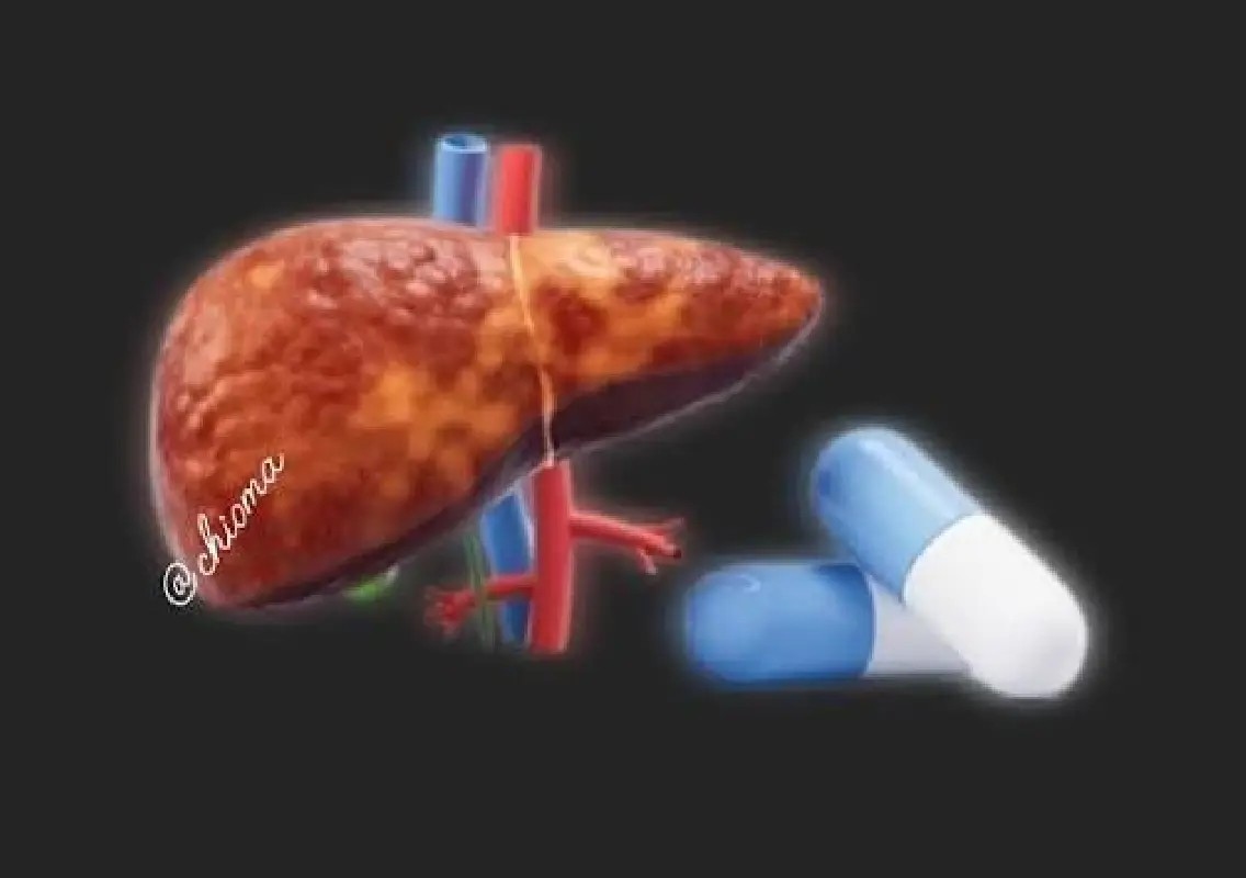 Toxic liver injuries linked to medicines rise sharply - News Karnataka