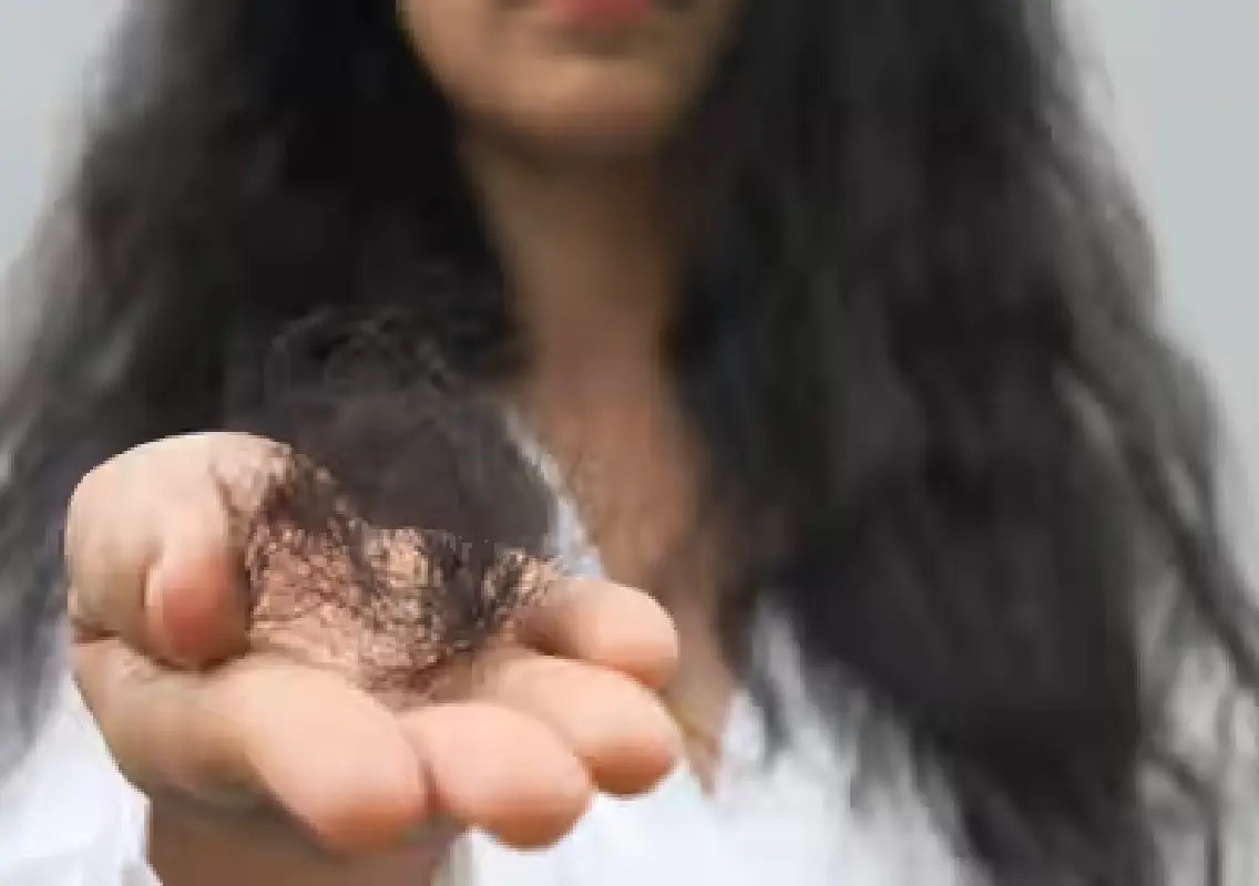 20-year-old’s 11-year hair-eating habit leads to massive hairball - News Karnataka