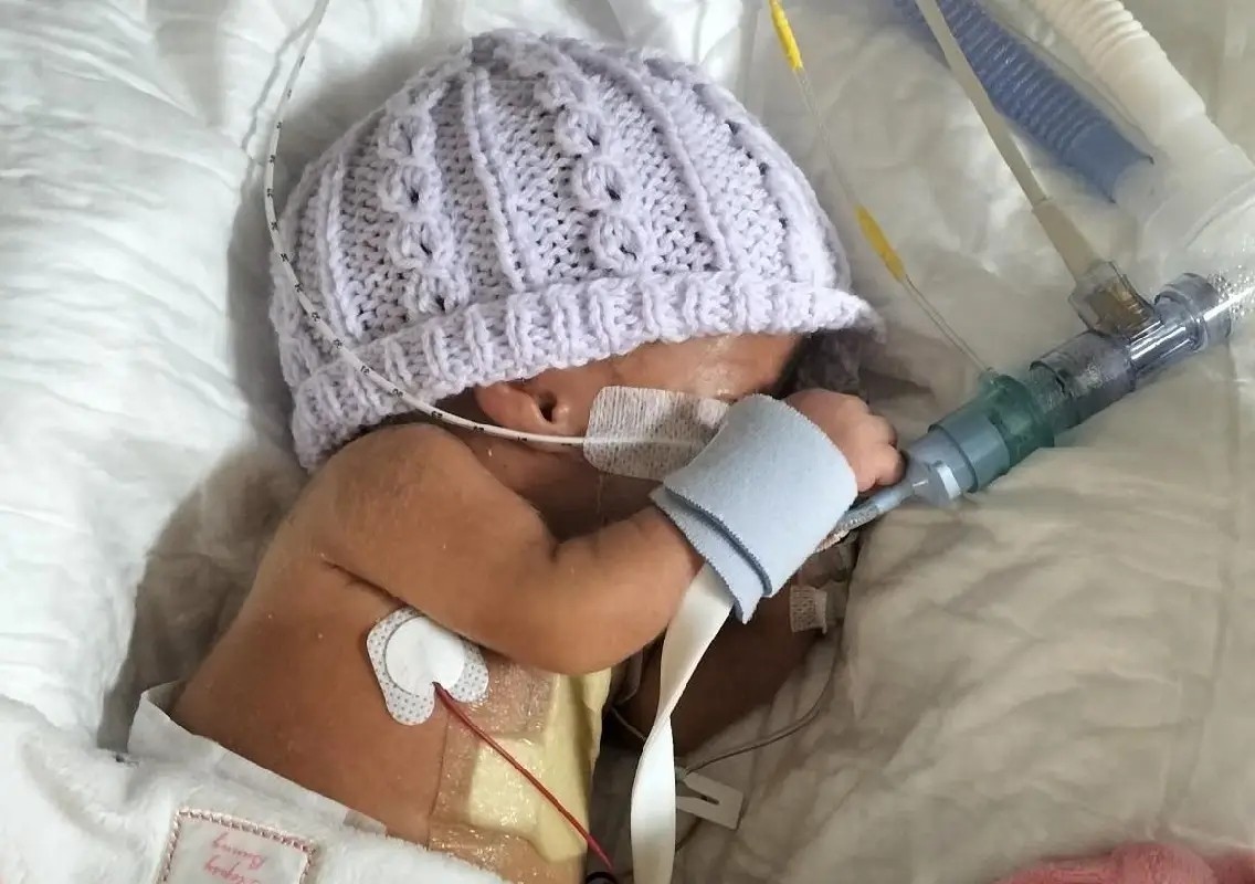 Delay in neonatal care reform raises fears for vulnerable babies - News Karnataka