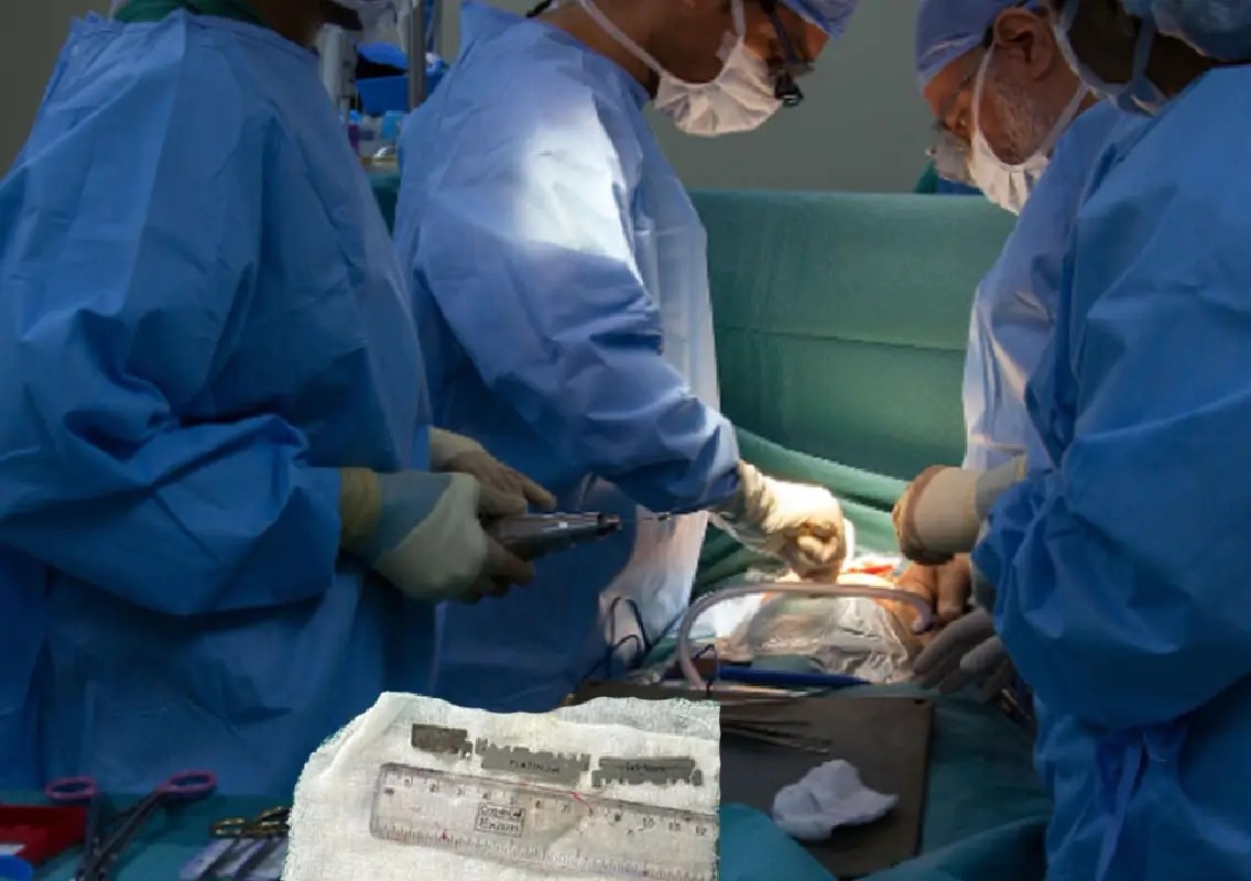 Doctors remove three razor blade pieces from Hyderabad teen’s stomach - News Karnataka