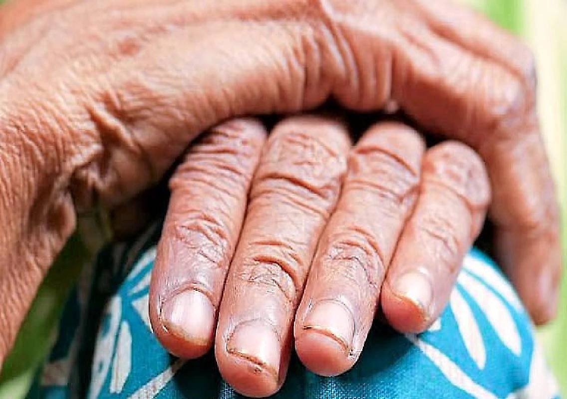 Innanje: 69-year-old woman dies after fire accident - News Karnataka