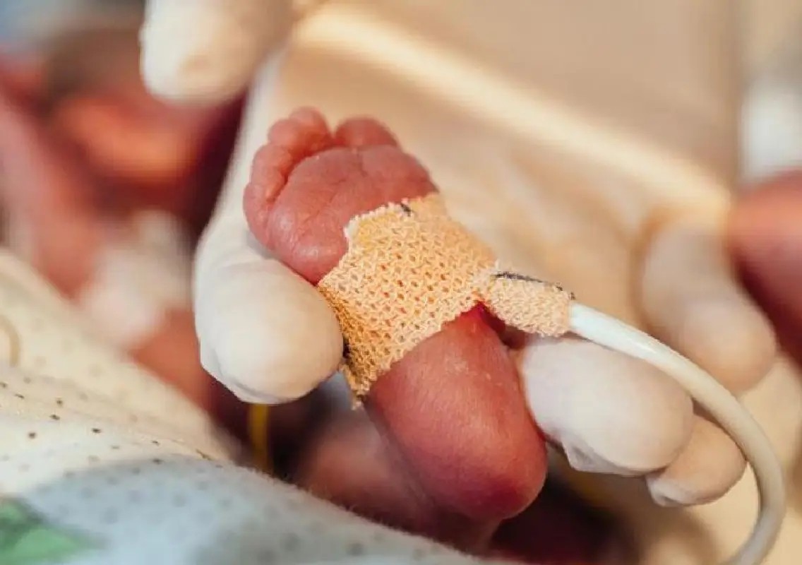 Needle found inside one-year-old girl after NICU treatment - News Karnataka