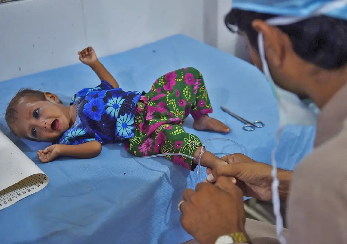 Pakistan urged to intensify fight against child stunting - News Karnataka