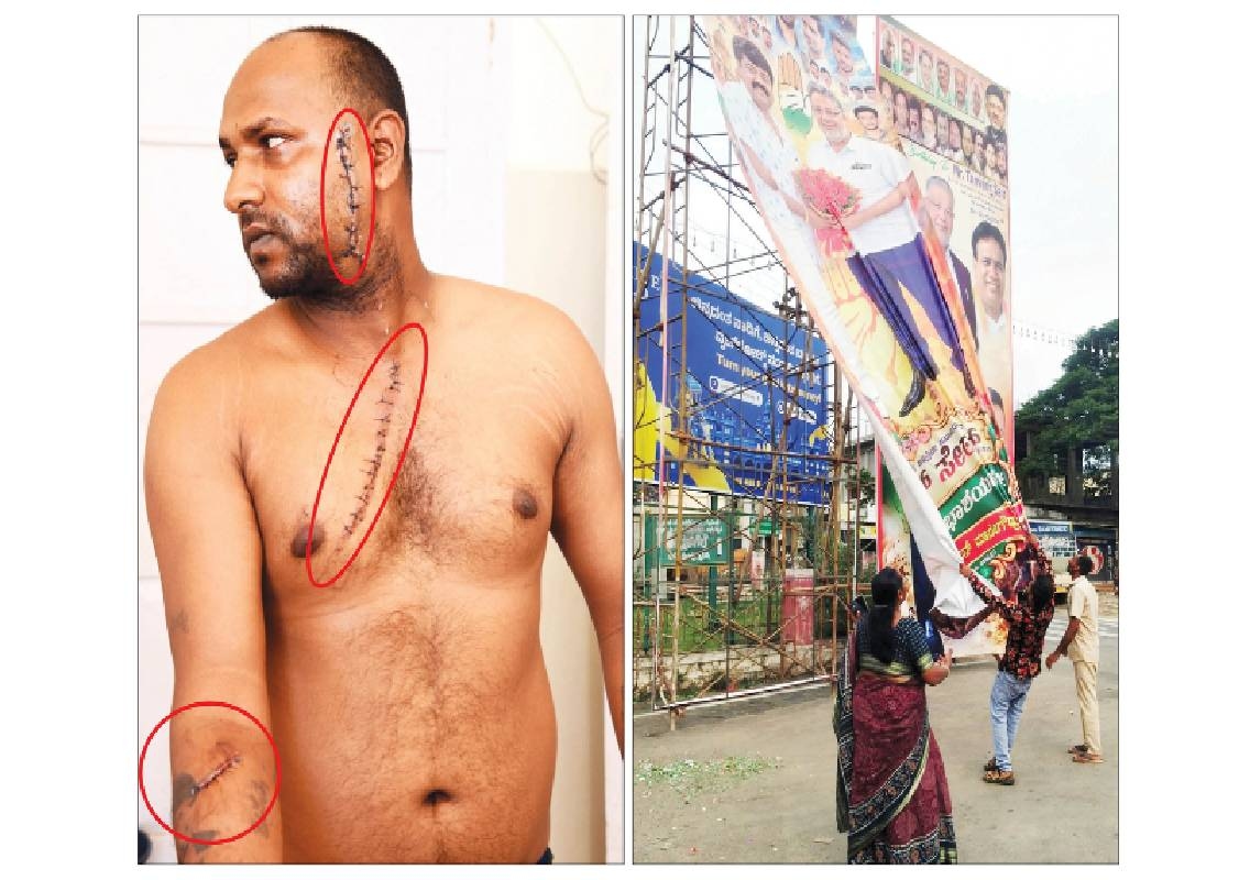 Mysore MCC worker attacked during flex removal drive - News Karnataka