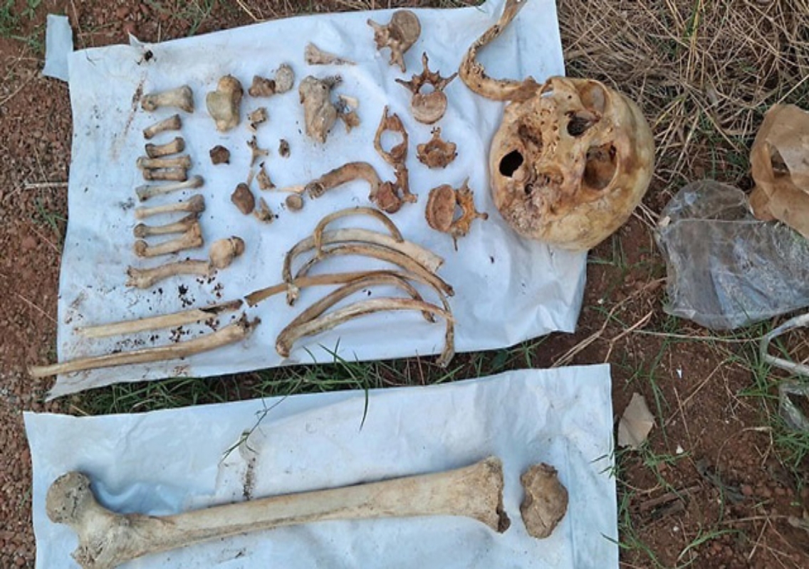 Human Skull and Bones Found in Udupi’s Ananth Nagar - News Karnataka