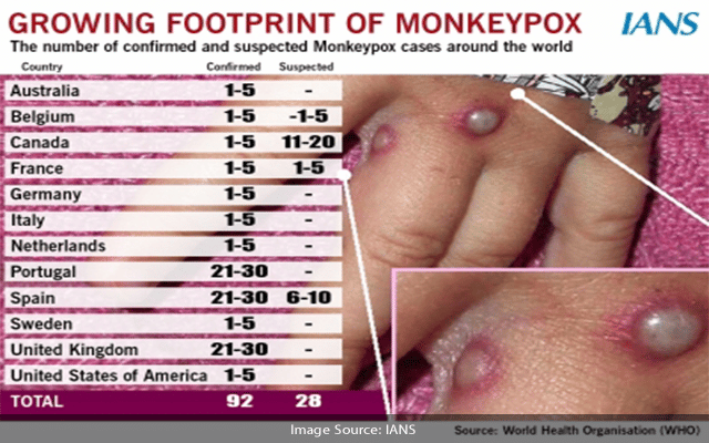 Experts Warn Of Unusual Monkeypox Outbreak In Aus