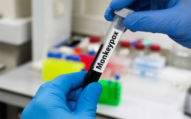 Amaravati: Boy in Andhra tests negative for monkeypox