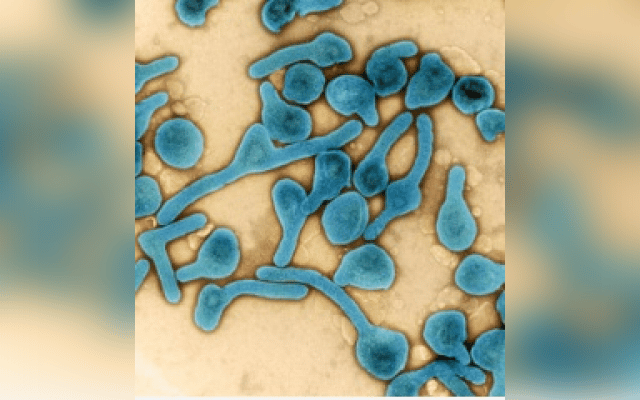 Ghana records one recovered case of Marburg virus disease