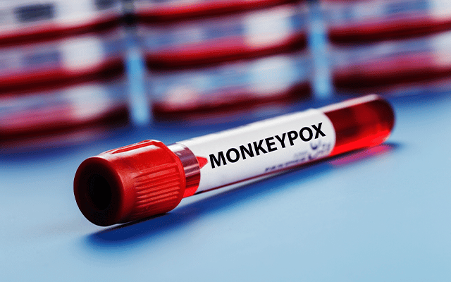 Canada , monkeypox case in a child