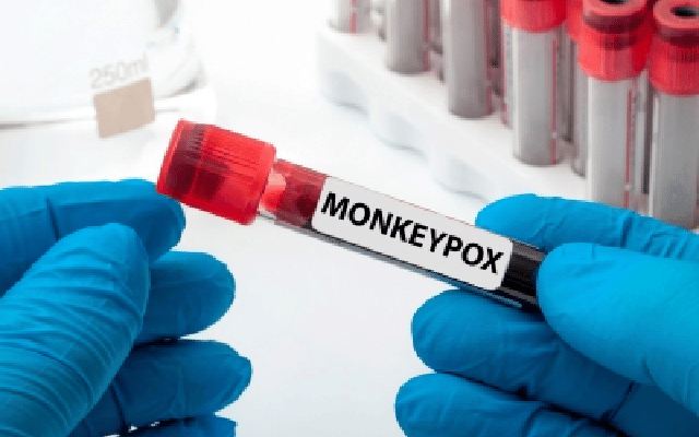 Canada confirms 1,363 monkeypox cases