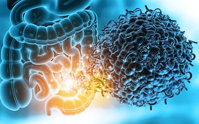 Study shows our gut microbes may determine bone health