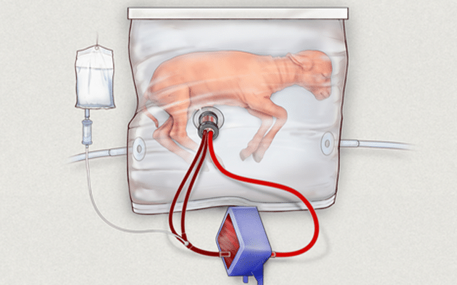 ‘Artificial wombs’ may soon see human trials: Report